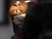 A dentist at the Centro de Odontogeriatria TIII Doctor Guillermo Roman y Carrillo, located in the Iztapalapa district of Mexico City, is att...