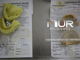Dental impressions are being viewed inside the Centro de Odontogeriatria Centro de Salud TIII Doctor Guillermo Roman y Carrillo, located in...