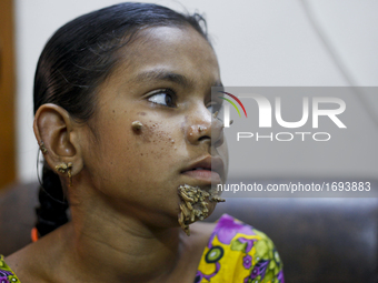 Doctors in Bangladesh will form a medical board to assess a 10-year-old girl with bark-like warts growing out of her face, believed to be tr...