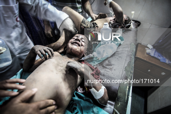 A child is treated in Gaza City after being injured during Israeli targeted airstrikes, on July 9, 2014. Countless airstrikes have hit targe...