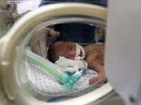 A prematurity Palestinian new born baby in Shifa Hospital  in Gaza, Palestine, on 11 May 2017 suffer from a shortage of milk due to the sieg...