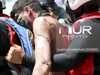 An injured anti-government demonstrator is carried away as security forces block a march from reaching the office of Attorney General Luisa...
