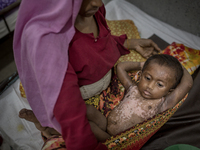 
A wounded Rohingya kid is admitted to the hospital as he got burn injury since Myanmar military torched his house down.  Cox’s Bazar Hospi...