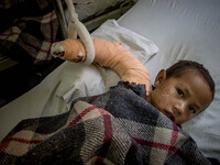 Ima Riji Lama, 4 got a fracture in his right hand during the earthquake. Teaching Hospital, Kathmandu, Nepal. May 6, 2015. (