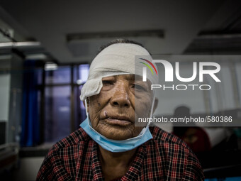 Krishna Maya, 72 an earthquake survivor got bad head injury due to earthquake. Trauma Hospital, Kathmandu, Nepal. May 6, 2015. (