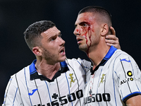 Merih Demiral of Atalanta BC has a bloody face after during the Serie A match between US Salernitana 1919 and Atalanta BC at Stadio Arechi,...