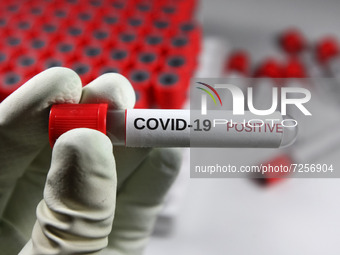 A test sample tube labelled 'COVID-19 positive' is pictured in this illustration of the coronavirus variant taken in Kyiv on 22 October, 202...