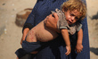 A displaced Palestinian mother is carrying her son, who is suffering from a skin rash, whi...