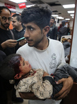 Injured Palestinians 