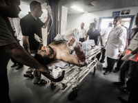 A man is treated in Gaza City after being injured during Israeli targeted airstrikes, on July 9, 2014. Countless airstrikes have hit targets...