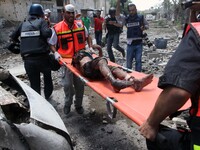 Medic helps a Palestinian in the Shejaia neighbourhood, which was heavily shelled by Israel during fighting, in Gaza City July 20, 2014. At...