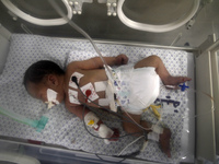 Palestinian baby girl Shayma Shiekh al-Eid lies in an incubator after doctors delivered her from the womb of her mother, whom medics said wa...