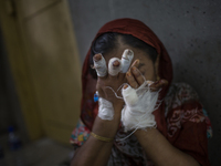 Severely injured by Myanmar military a Rohingya woman tries to wipe her face at Cox’s Bazar Hospital, Chittagong. September 18, 2017. (