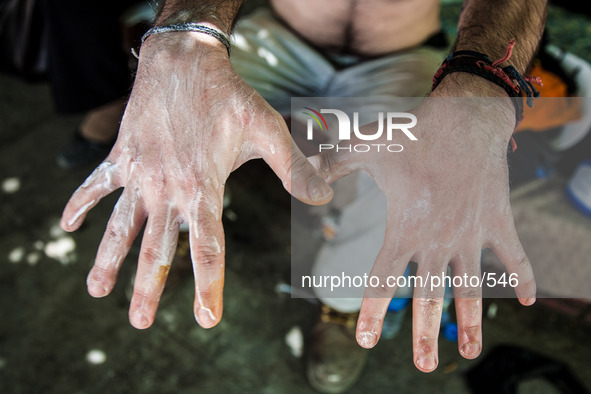 ISTANBUL, TURKEY--A man says his hands were burned by the gas police used against protesters. 