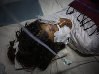 Sakuntala, 24 is an earthquake survivor from Bhaktapur. Her uncle is using oinment on her wounds. Trauma Hospital, Kathmandu, Nepal. May 6,...