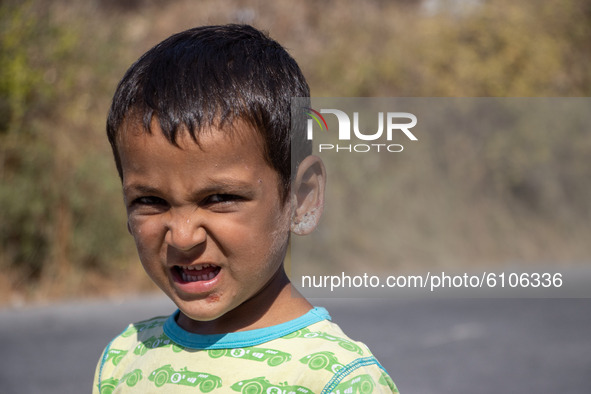 A little boy with his ear injured after the fire. Portraits of young children refugees, minors boys and girls, asylum seekers from various c...