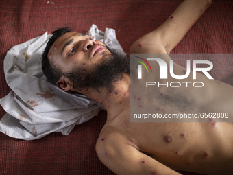 (EDITORS NOTE: Image contains graphic content) A person, who was injured in clashes, in Dhaka, Bangladesh on March 26, 2021 during a protest...