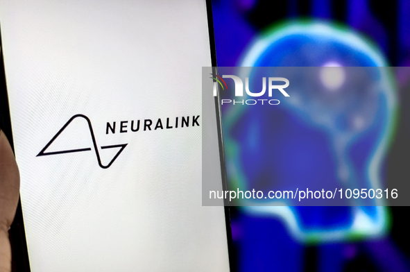 An illustration of Neuralink is being displayed in Suqian, Jiangsu Province, China, on January 30, 2024. Musk is announcing that Neuralink h...