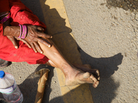 The swollen and strained legs of a Nepali loan shark victim, who has been walking for weeks to reach the capital Kathmandu, are being pictur...