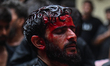 A Shiite Muslim man is being seen with blood on his face during a procession to mark Ashur...