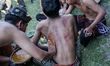A Balinese man administers traditional medicine to his friend to heal a wound after the Me...