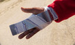 Injured hand of migrant in Calais, France, on October 25, 2016, during eviction from “The...