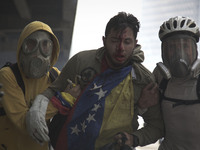An injured person is carried by demonstrators during clash with police during a march against Venezuelan President Nicolas Maduro, in Caraca...