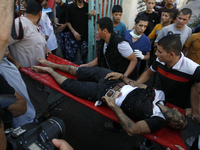 A wounded Palestinian man arrives at the hospital a after an Israeli air strike, in Rafah, in the southern Gaza Strip on August 3, 2014. At...