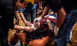 A woman suffering from the effects of tear gas is treated inside the Divan Hotel behind Ge...