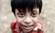 A Down syndrome Yasin Alam Tahmid age of 6. World Down Syndrome Day (WDSD) is observed on...