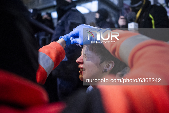 An injured demonstrator during a protest against the abortion ban law, in Warsaw, Poland, on January 20, 2021. 
