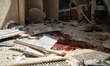 Al-Atareb Hospital in Aleppo Governorate, northern Syria, which is under the control of th...
