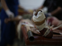 Foot of an injured man lies inside a field hospital after what activists said was mortar shelling by forces of Syria's President Bashar al-A...