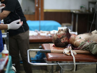 An injured man lies inside a field hospital after what activists said was mortar shelling by forces of Syria's President Bashar al-Assad on...